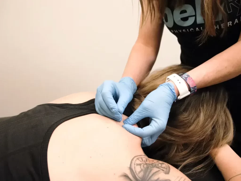 A physical therapist wearing blue gloves applies acupuncture needles to a person's back. The person is lying down, with a visible tattoo on their shoulder.