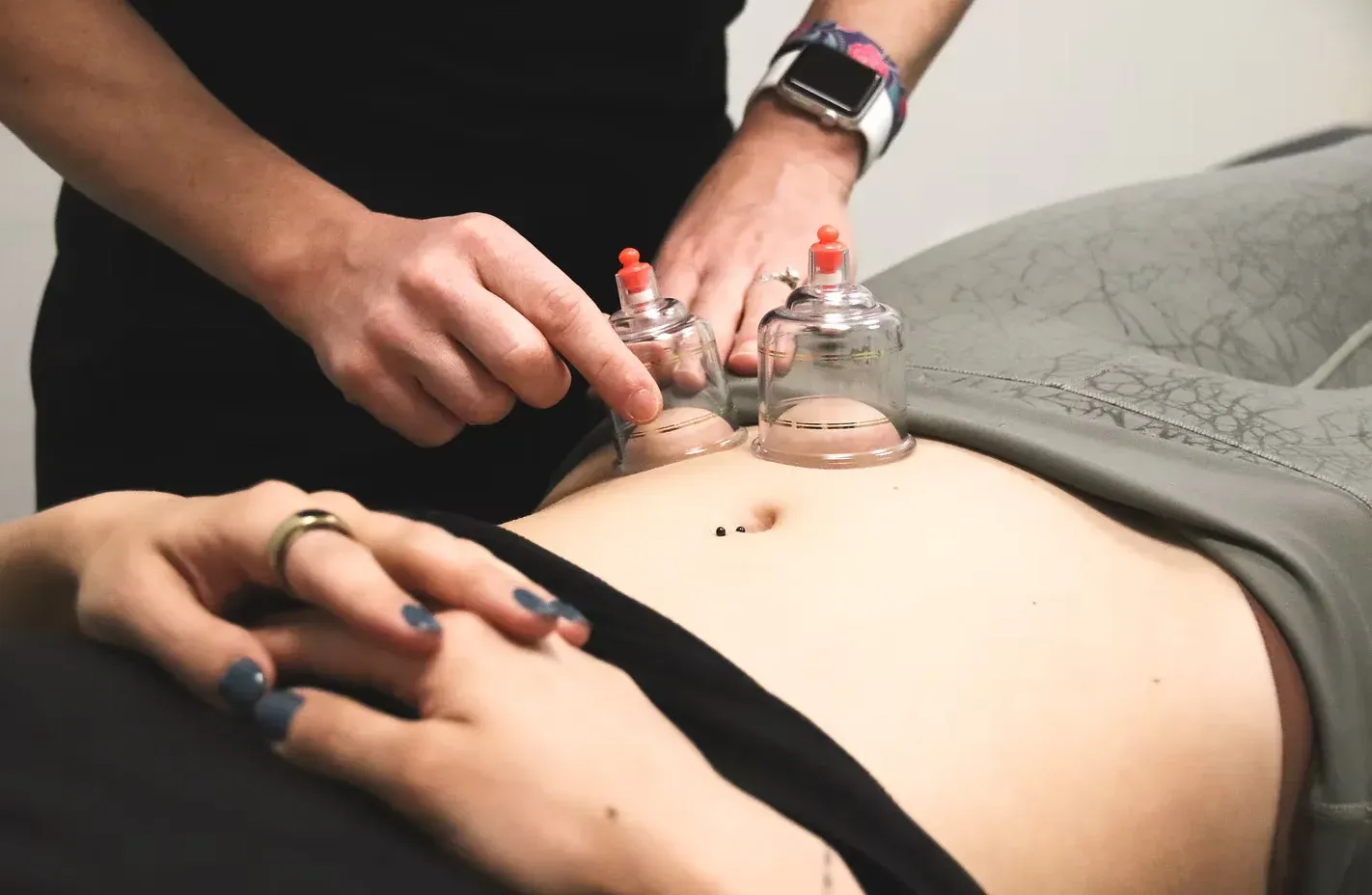 Close-up of a person's abdomen with two cupping therapy cups attached, held by a practitioner. The atmosphere is calm and focused.